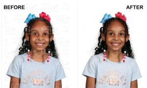 ai watermark remover